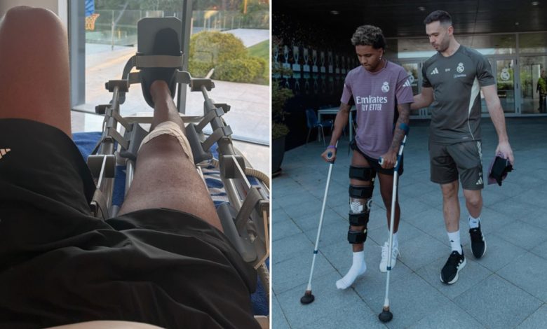 تعافي رودريجو