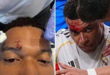 ركلة جزاء مبابي ضد جيرونا