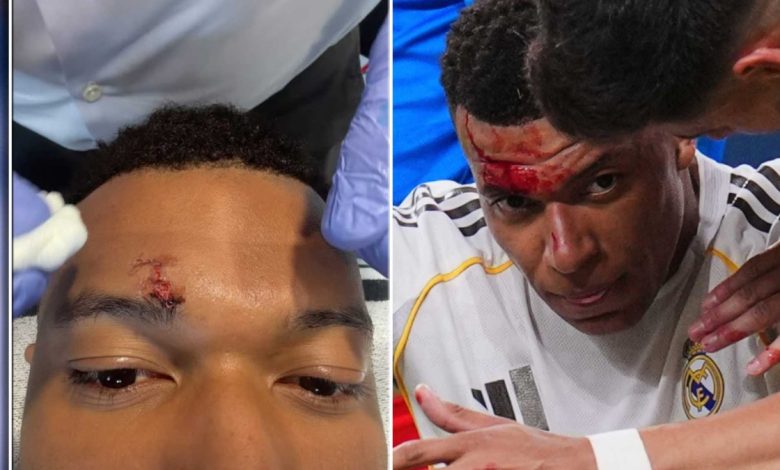 ركلة جزاء مبابي ضد جيرونا