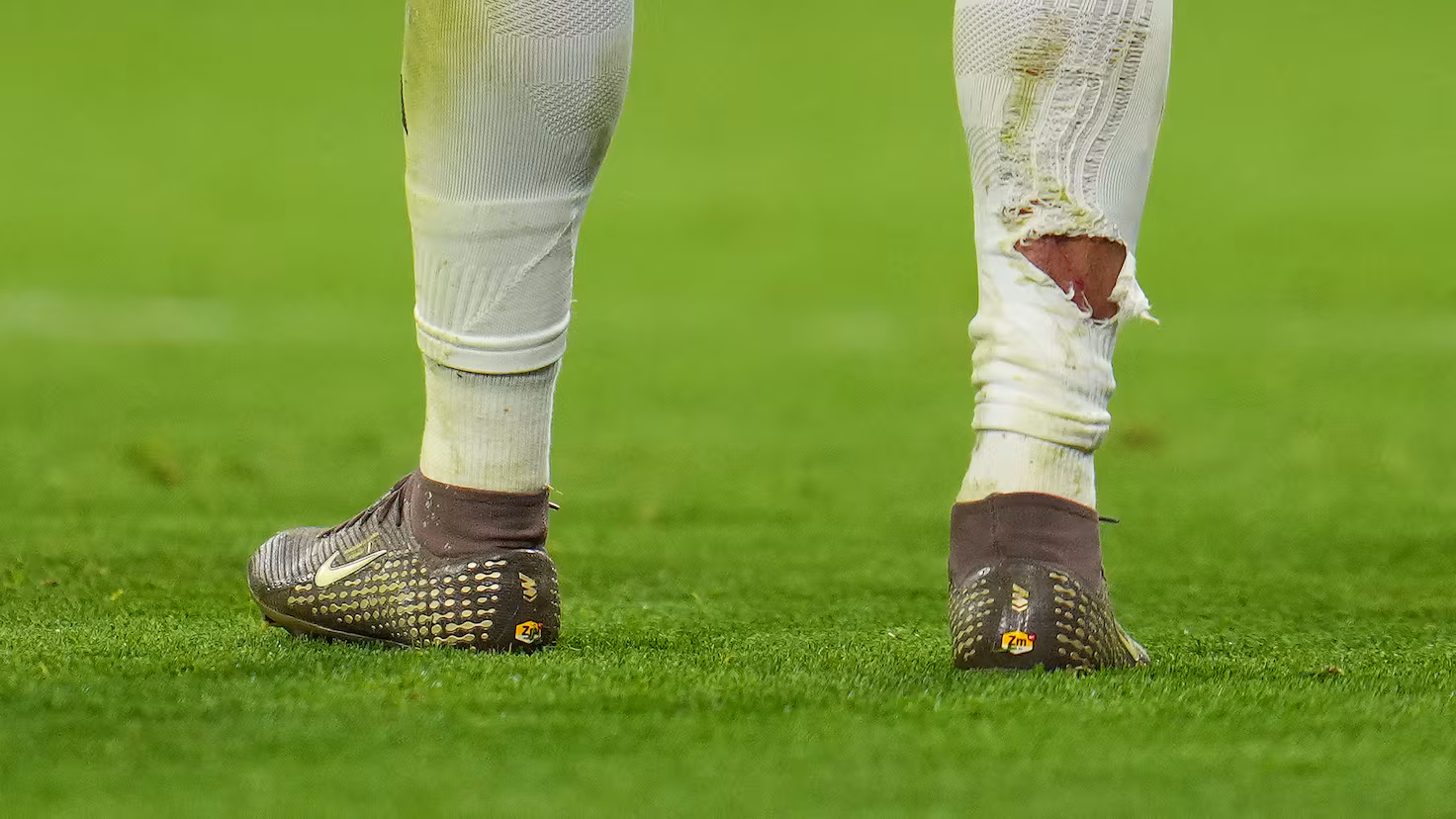 تدخل تاه على مبابي